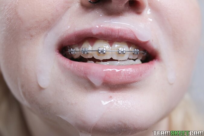 Lexi Lore gets braces covered in thick cum from Kyle Mason