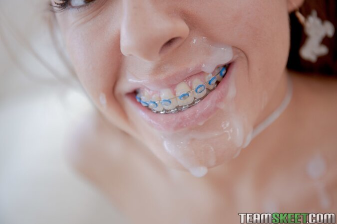Vanna Bardot takes hard fuck and cum all over her braces